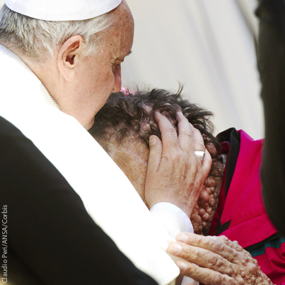 Pope Francis kisses disfigured man